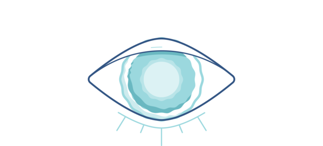 Grafika zamglonego oka