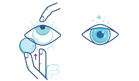 Technika umieszczania soczewek kontaktowych w oku